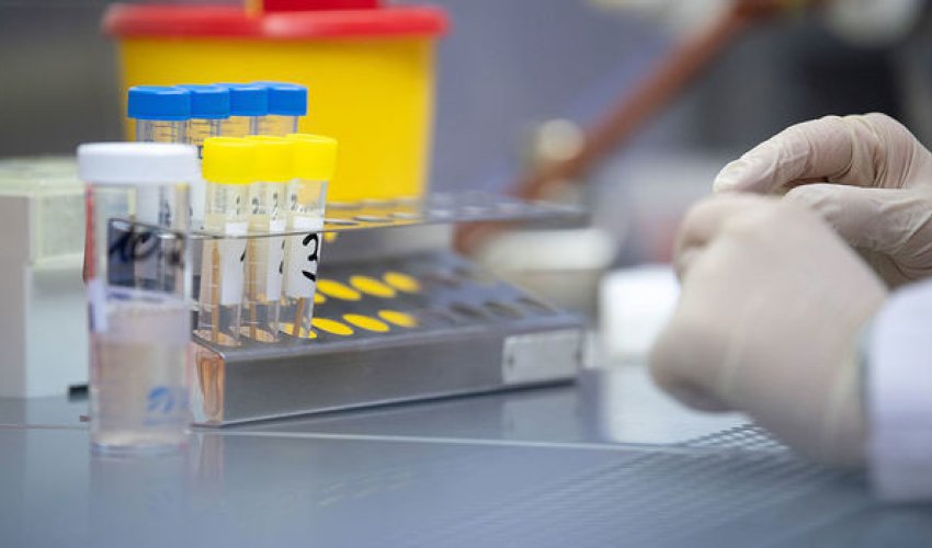 Azərbaycanda koronavirusa yoluxanların sayı yenidən artdı Azərbaycanda koronavirusa yoluxanların sayı yenidən artdı