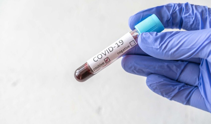 В Азербайджане еще 2 ученика и 7 сотрудников школ заразились коронавирусом