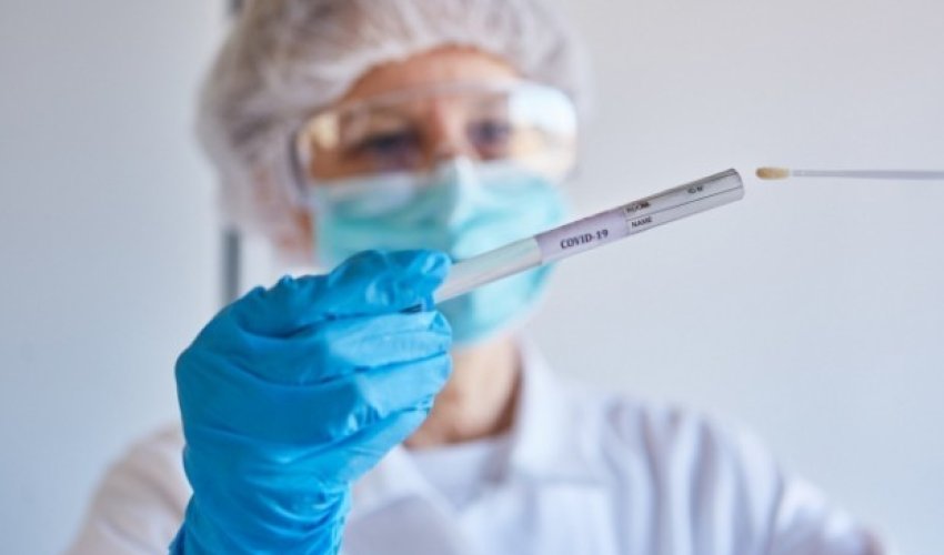 Son sutkada 7 mindən çox test aparılıb Son sutkada 7 mindən çox test aparılıb