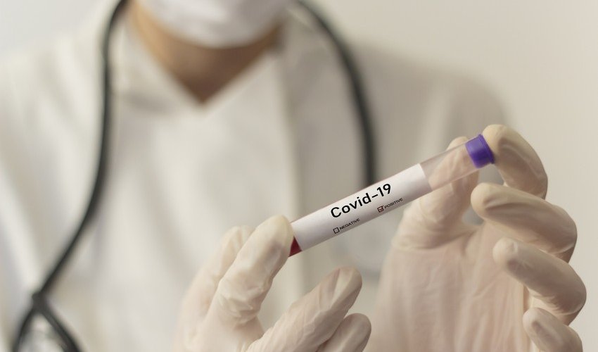 Yaponiyada daha əvvəllər bilinməyən koronavirus ştammı aşkar edilib Yaponiyada daha əvvəllər bilinməyən koronavirus ştammı aşkar edilib