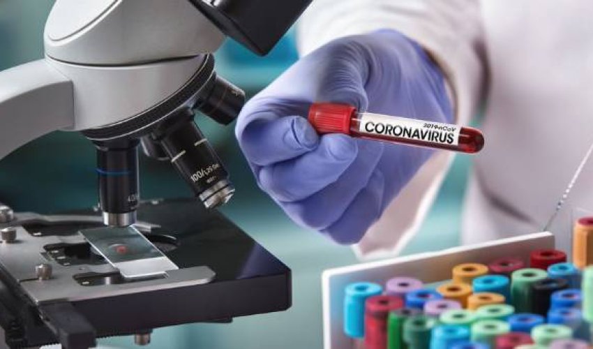 SON DƏQİQƏ! Azərbaycanda son sutkada koronavirusa yoluxanların sayı açıqlandı - FOTO SON DƏQİQƏ! Azərbaycanda son sutkada koronavirusa yoluxanların sayı açıqlandı - FOTO