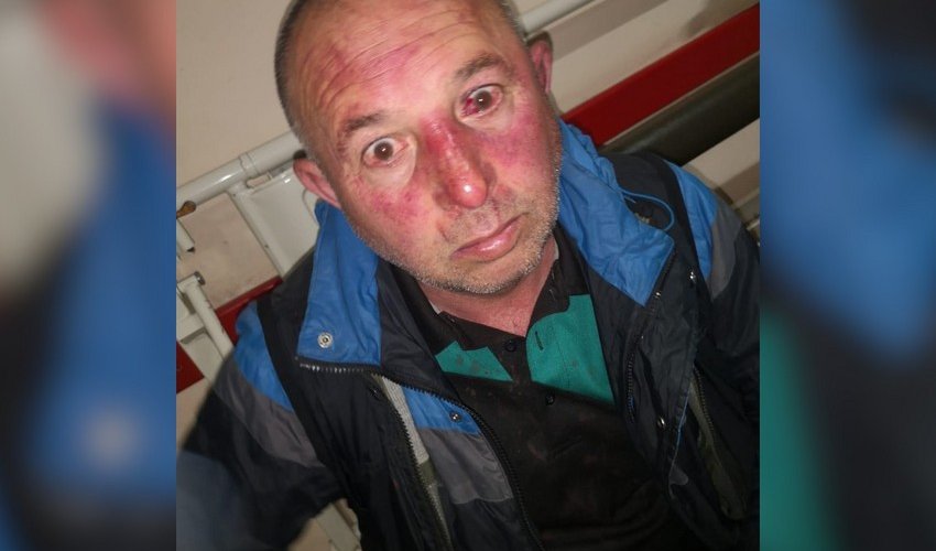 В Киеве на азербайджанцев напали с холодным оружием, есть раненые В Киеве на азербайджанцев напали с холодным оружием, есть раненые