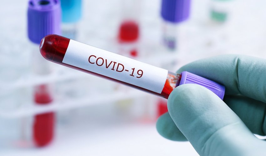 В Азербайджане за минувшие сутки выявлены 32 новых случая инфицирования коронавирусом В Азербайджане за минувшие сутки выявлены 32 новых случая инфицирования коронавирусом