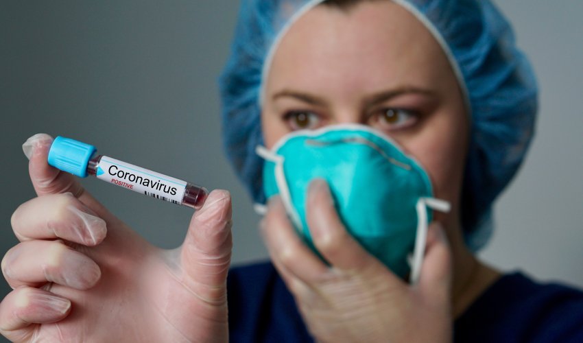 В Азербайджане за минувшие сутки выявлены 75 новых случаев инфицирования коронавирусом