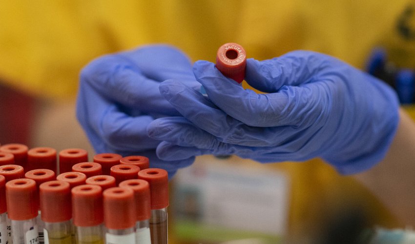 В Азербайджане за последние сутки коронавирусом заразились 1 017 человек В Азербайджане за последние сутки коронавирусом заразились 1 017 человек