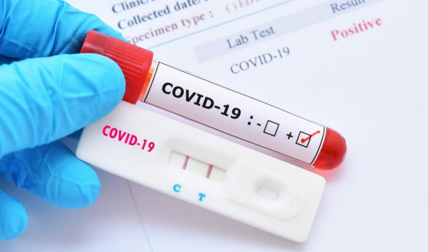 COVİD-19-a qarşı yeni dərman təsdiqləndi COVİD-19-a qarşı yeni dərman təsdiqləndi