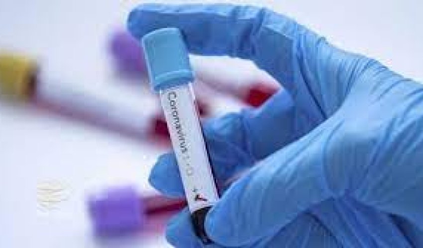 Azərbaycanda bu günə olan koronavirus statistikası Azərbaycanda bu günə olan koronavirus statistikası