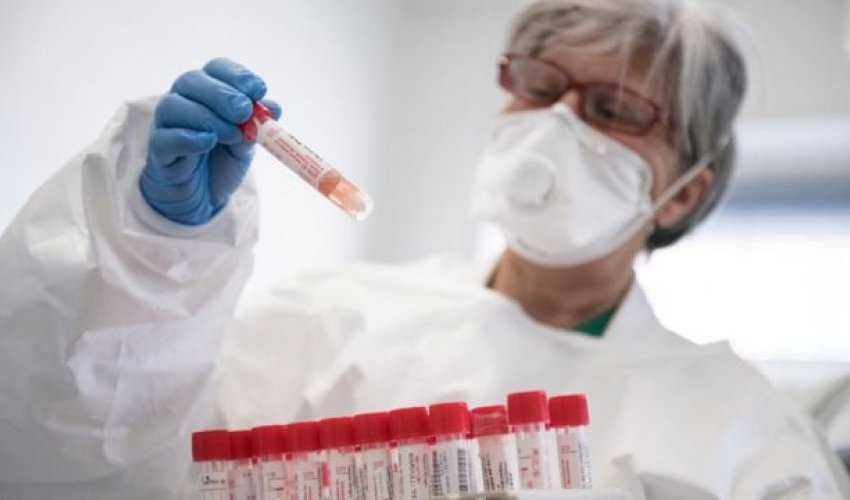 Azərbaycanda bu günə olan koronavirus statistikası Azərbaycanda bu günə olan koronavirus statistikası