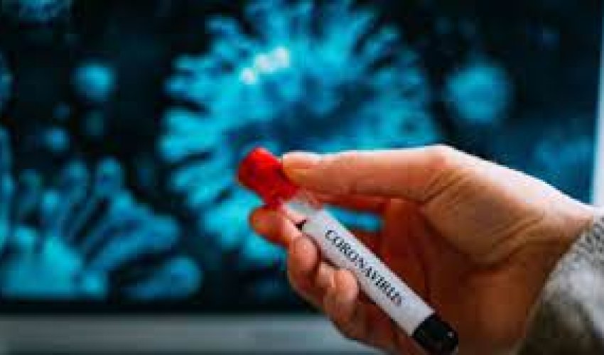 Azərbaycanda bu günə olan koronavirus statistikası Azərbaycanda bu günə olan koronavirus statistikası