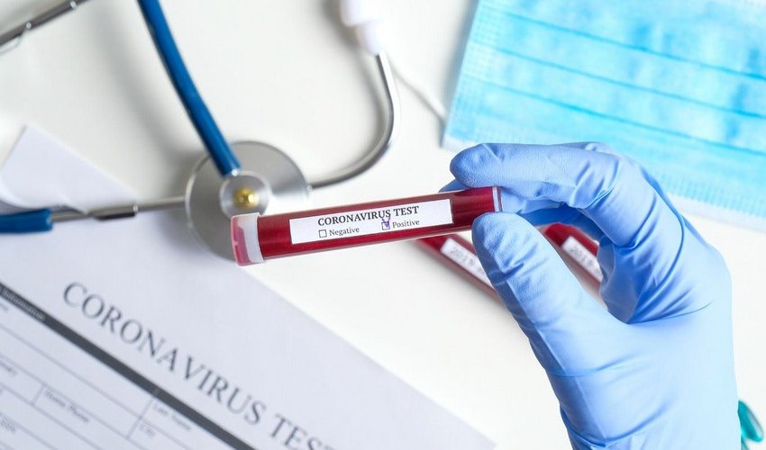 Azerbaijan confirms 1,151 new cases, 9 deaths Azerbaijan confirms 1,151 new cases, 9 deaths
