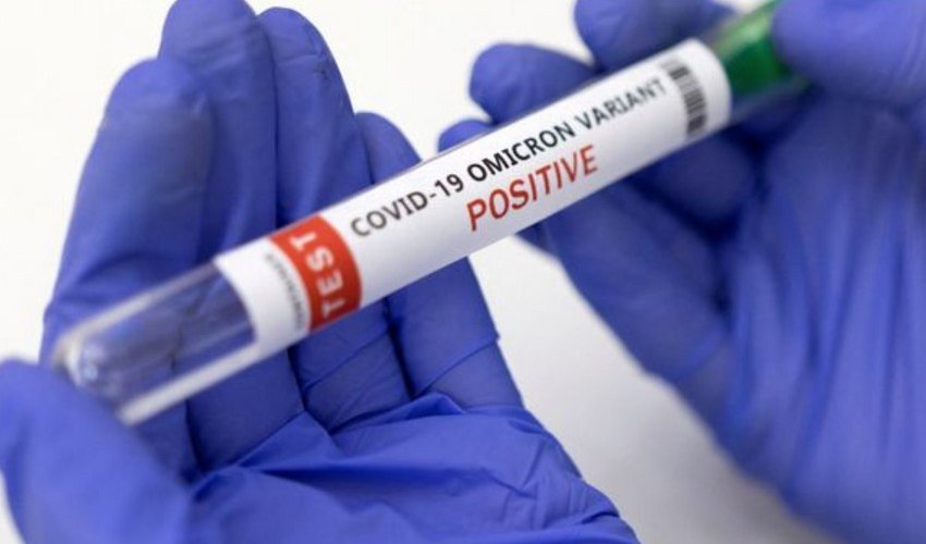 В Азербайджане за сутки выявлен 3 361 новый случай заражения COVID-19 В Азербайджане за сутки выявлен 3 361 новый случай заражения COVID-19