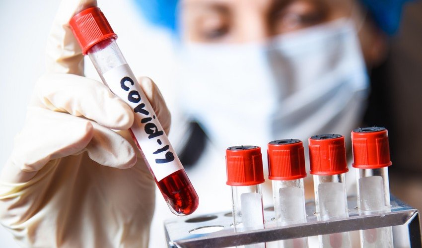 Azerbaijan confirms 2,186 new COVID cases, 14 deaths