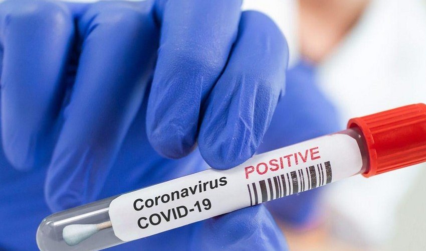 Azerbaijan reports 6,620 new COVID-19 cases on February 2 Azerbaijan reports 6,620 new COVID-19 cases on February 2