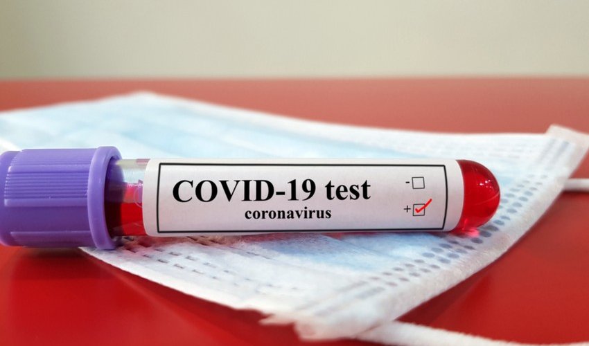 Azerbaijan confirms 865 new COVID-19 cases, 16 deaths Azerbaijan confirms 865 new COVID-19 cases, 16 deaths