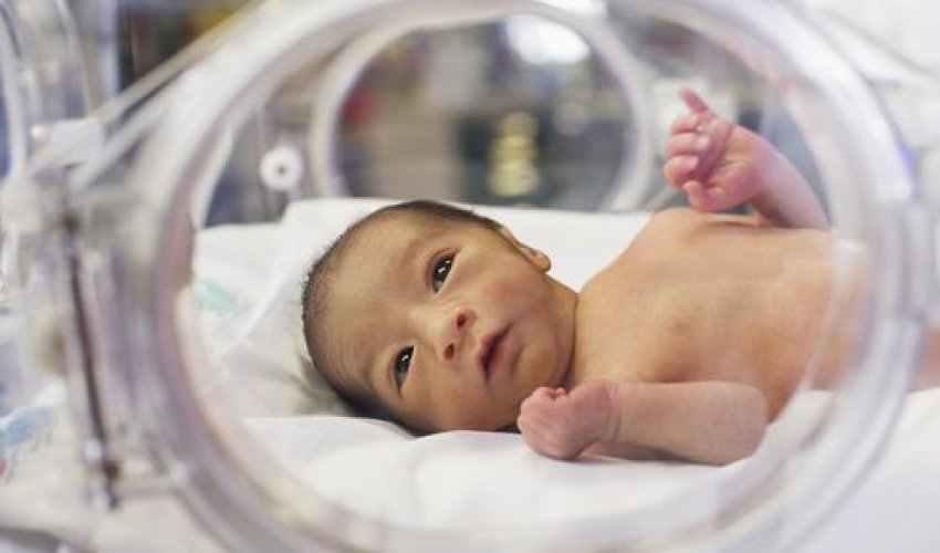 Hər il 15 milyona yaxın uşaq vaxtından əvvəl doğulur Hər il 15 milyona yaxın uşaq vaxtından əvvəl doğulur