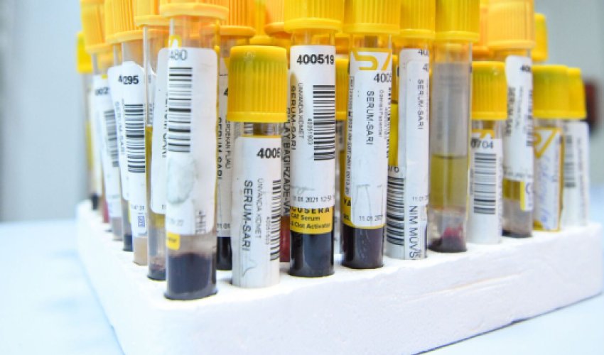 Статистика по COVID в Азербайджане Статистика по COVID в Азербайджане
