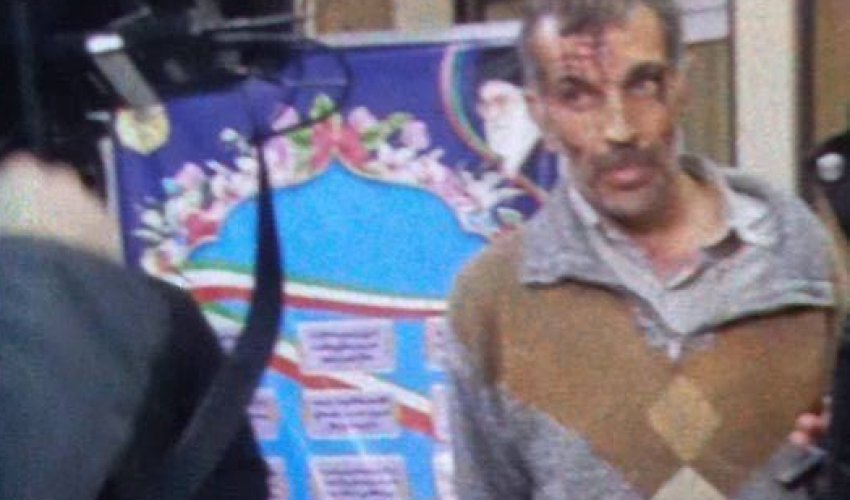Фото напавшего на посольство Азербайджана террориста Фото напавшего на посольство Азербайджана террориста