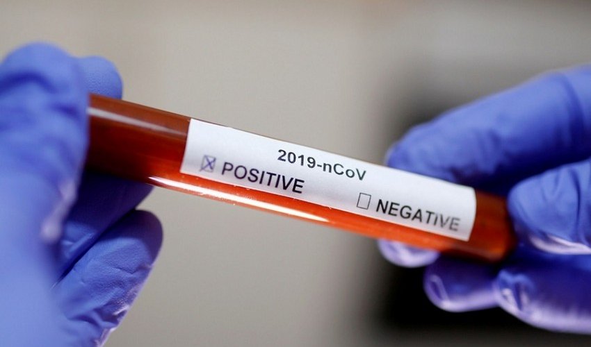 WHO cancels COVID-19 pandemic status WHO cancels COVID-19 pandemic status