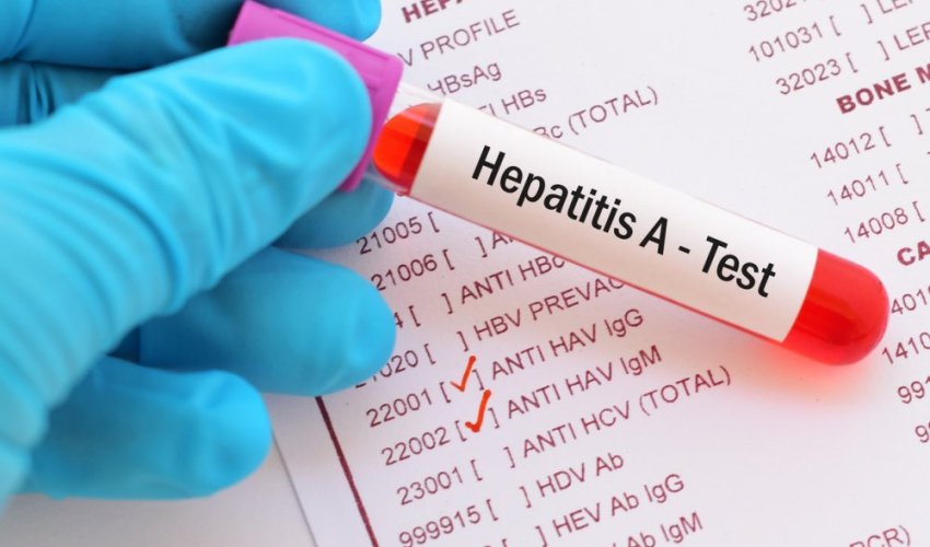 Mingəçevirdə məktəblilərdə “Hepatit A” virusu aşkarlanıb Mingəçevirdə məktəblilərdə “Hepatit A” virusu aşkarlanıb