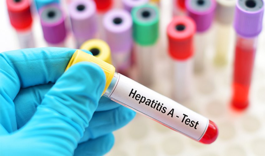 Hepatit virusuna yoluxan uşaqların son vəziyyəti AÇIQLANIB