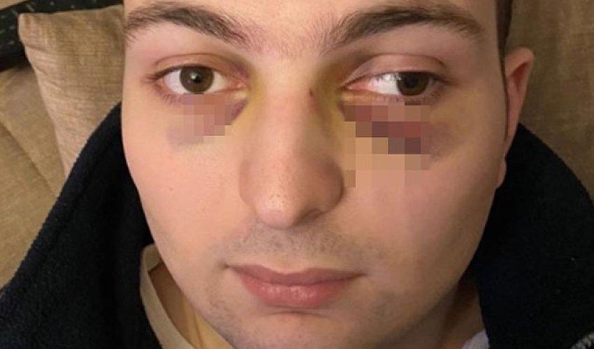 Ticarət mərkəzində döyülən oğlanla bağlı araşdırma başlanılıb Ticarət mərkəzində döyülən oğlanla bağlı araşdırma başlanılıb