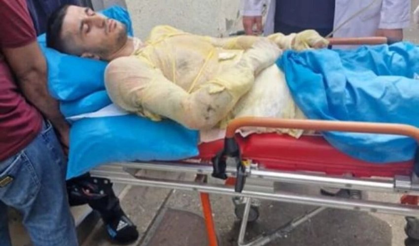 Qız qaçıran qazi özünü yandırıb Qız qaçıran qazi özünü yandırıb