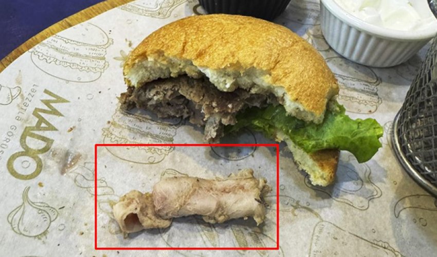 Uşaq üçün sifariş edilən yeməkdən ‘qığırdaq’ çıxdı – Restoran açıqlama vermir Uşaq üçün sifariş edilən yeməkdən ‘qığırdaq’ çıxdı – Restoran açıqlama vermir