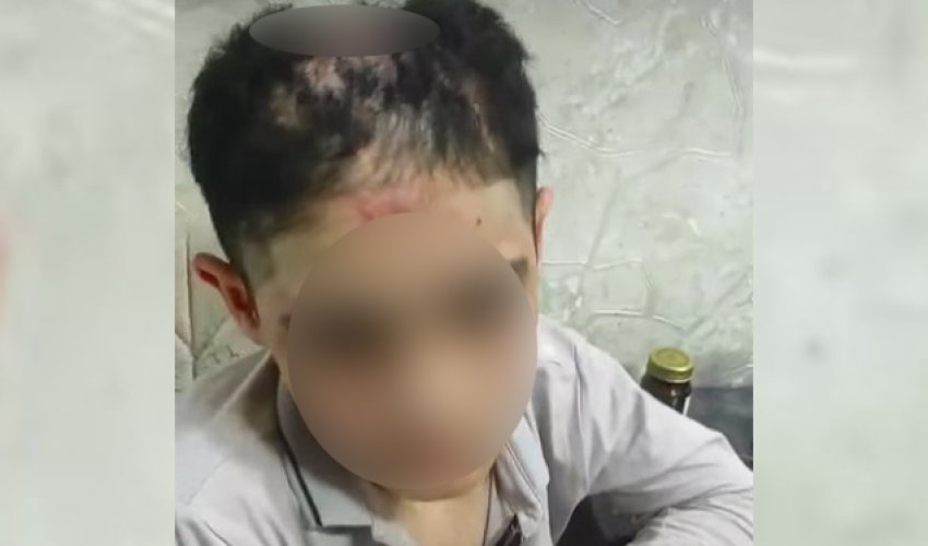 Подросток, подвергшийся насилию в семье опекунов, помещён в медучреждение Подросток, подвергшийся насилию в семье опекунов, помещён в медучреждение