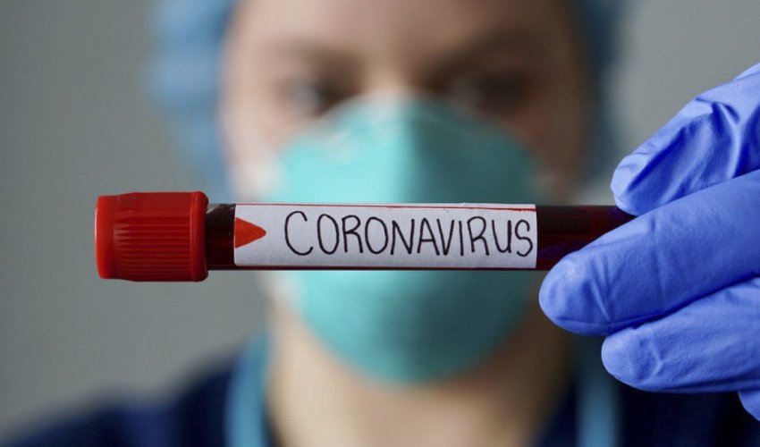 
COVID-19-la mübarizədə iştirak edən tibb işçilərinin əməkhaqlarına əlavənin müddəti artırılıb