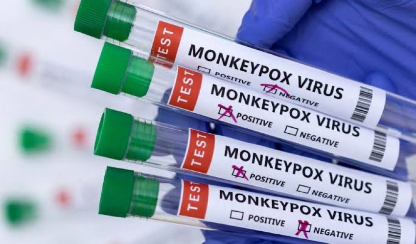 ÜST-dən meymunçiçəyi ilə bağlı - Xəbərdarlıq ÜST-dən meymunçiçəyi ilə bağlı - Xəbərdarlıq