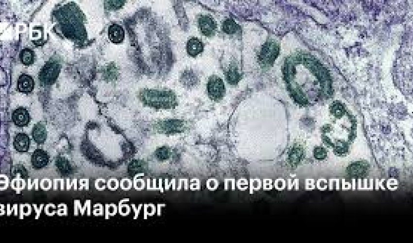 Efiopiyada təhlükəli virusun yayıldığı təsdiqlənib