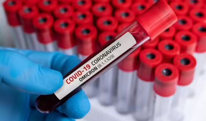 Son bir ayda dünya üzrə COVID19-dan ölüm sayı azalıb - ÜST