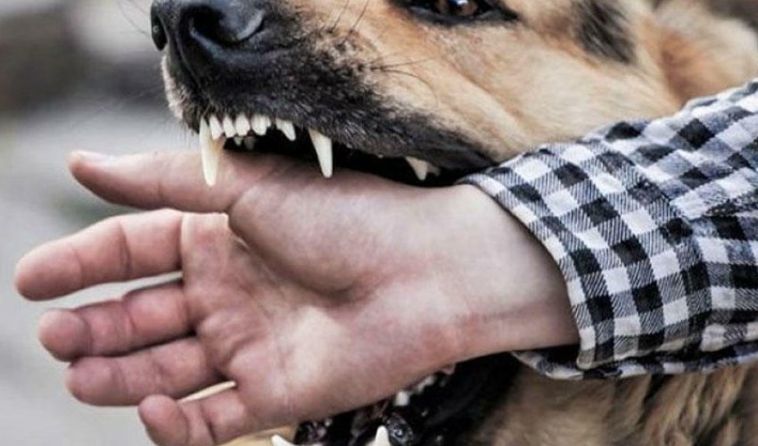 Bakının bu qəsəbəsində 1 ay ərzində 65 nəfəri it dişləyib