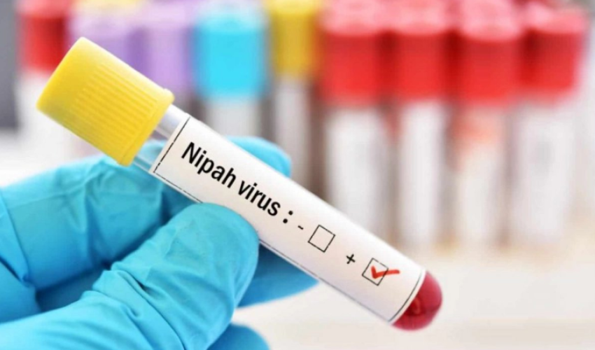 Nipah и глобальная уязвимость: может ли риск дойти до Азербайджана?