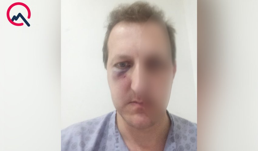 Bakıda Xalq artistinin oğlu döyülüb, bir nəfər saxlanılıb