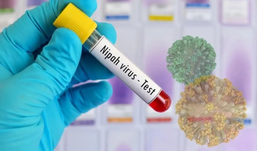 ÜST Hindistanda Nipah virusu ilə bağlı vəziyyəti yaxından izləyir