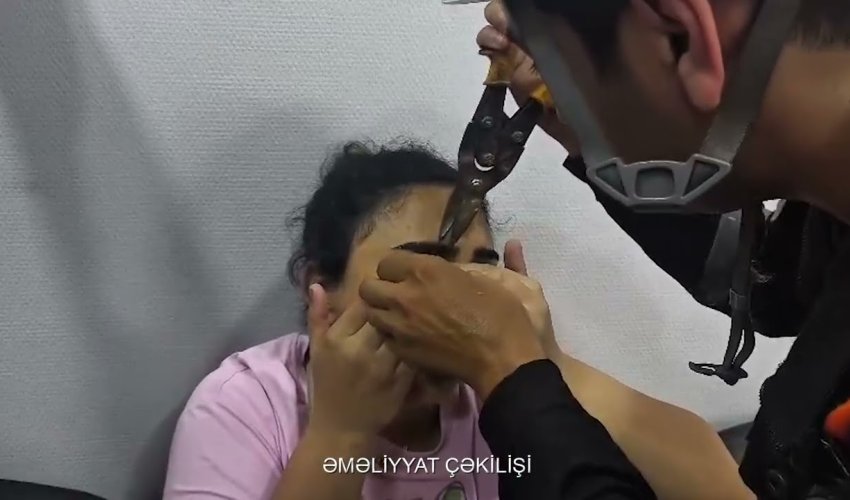 Göz qapağı geyiminin zəncirbəndinə ilişən qadına köməklik göstərilib - <span style=