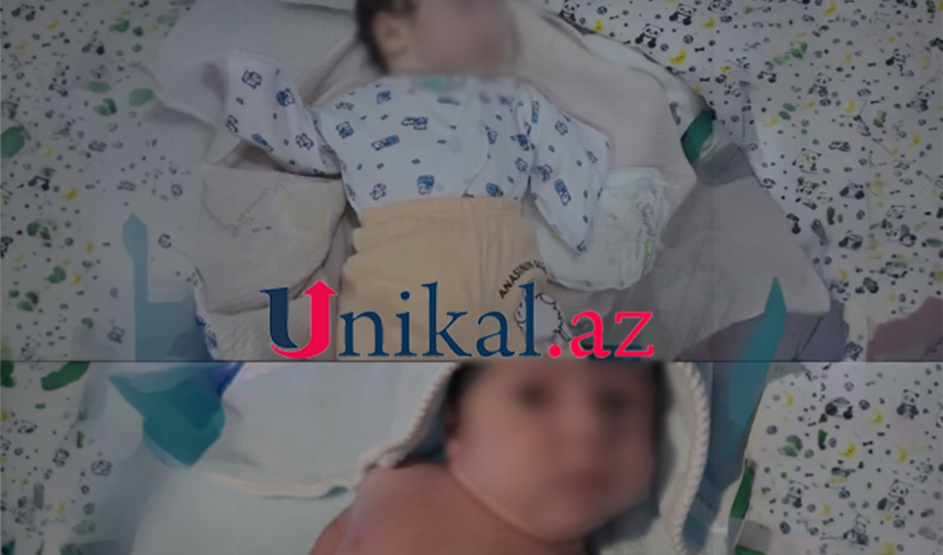 Sabunçuda qolları olmayan körpə doğulub, anası ondan imtina edib