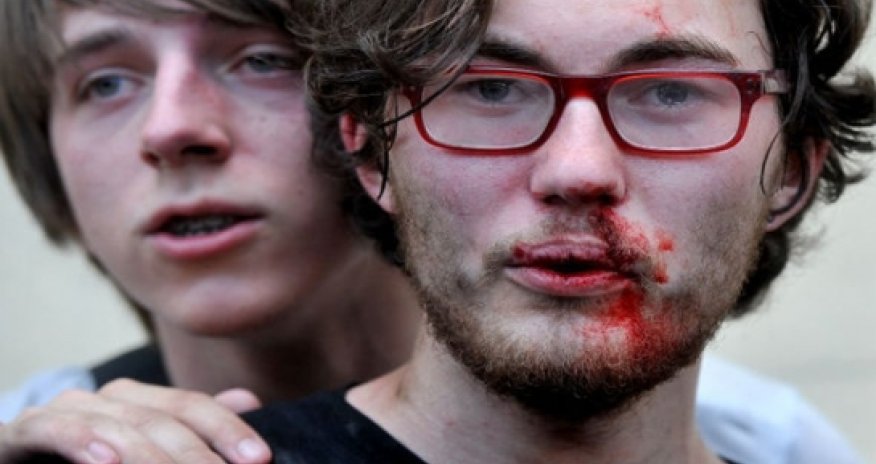 В Баку избили гея из Бейлагана