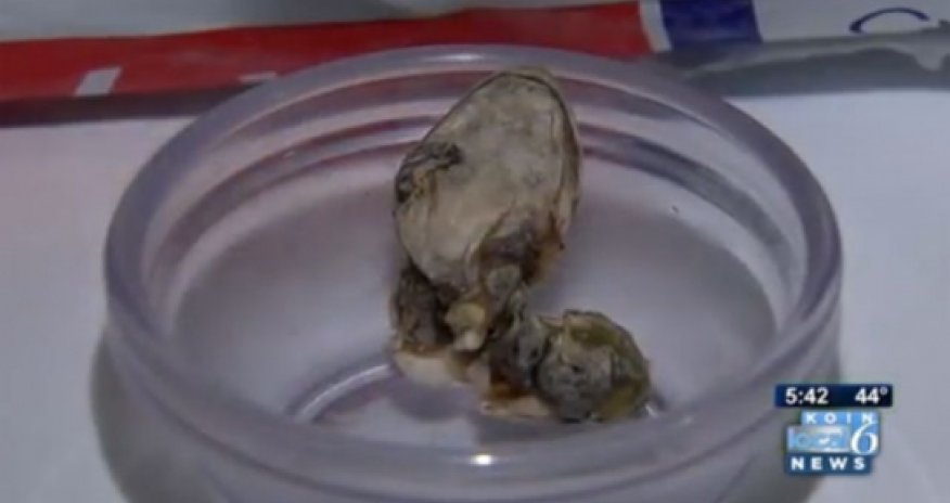 Женщина нашла голову змеи в упаковке фасоли- ВИДЕО