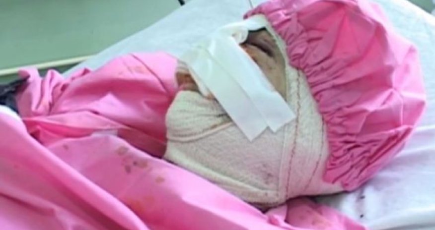 Афганец отрезал жене нос и губы -ФОТО+ВИДЕО