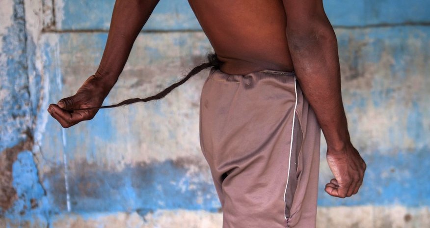 Индийца, у которого вырос хвост, признали божеством- ФОТО