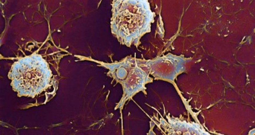 Multiple sclerosis discovery may explain gender gap