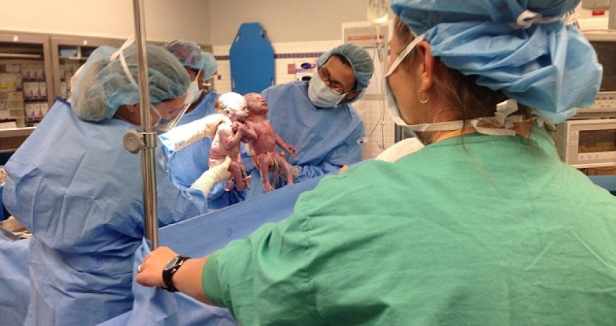 Rare 'mono mono' identical twin girls born HOLDING HANDS - PHOTO