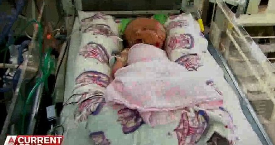 The baby with two faces - PHOTO+VIDEO