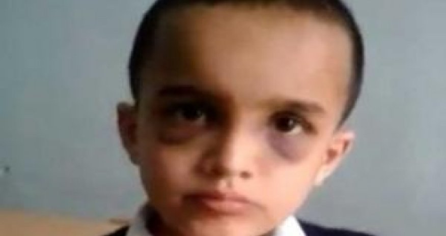 Criminal case launched on beating of 8-year-old child