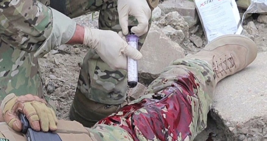 Tool can plug gunshot wounds in seconds