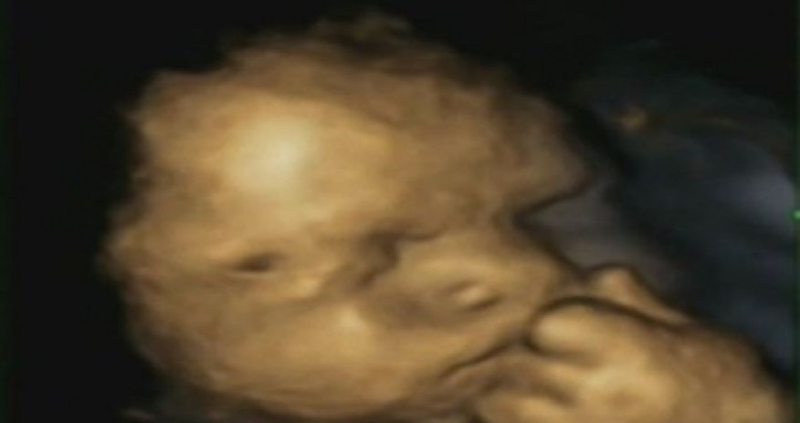 Is this picture proof that unborn babies feel mother's stress?