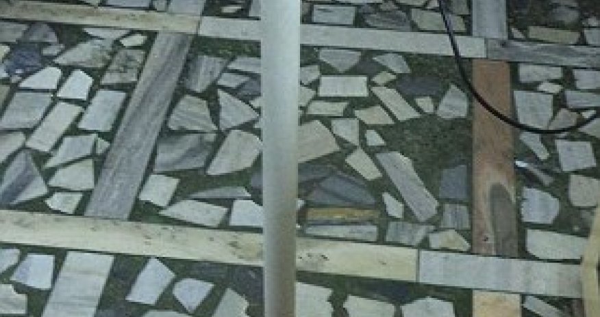 World's biggest tumour removed from the uterus of Indian woman - PHOTO