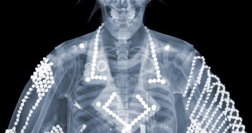 X-ray 'voyeur's' artwork provides a surprising glimpse... - PHOTO